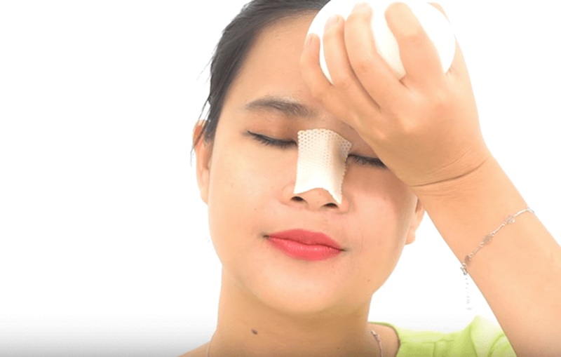 Chườm lạnh ngay trong 48 giờ đầu sau nâng mũi giúp co mạch, giảm sưng và làm dịu cơn đau nhức hiệu quả