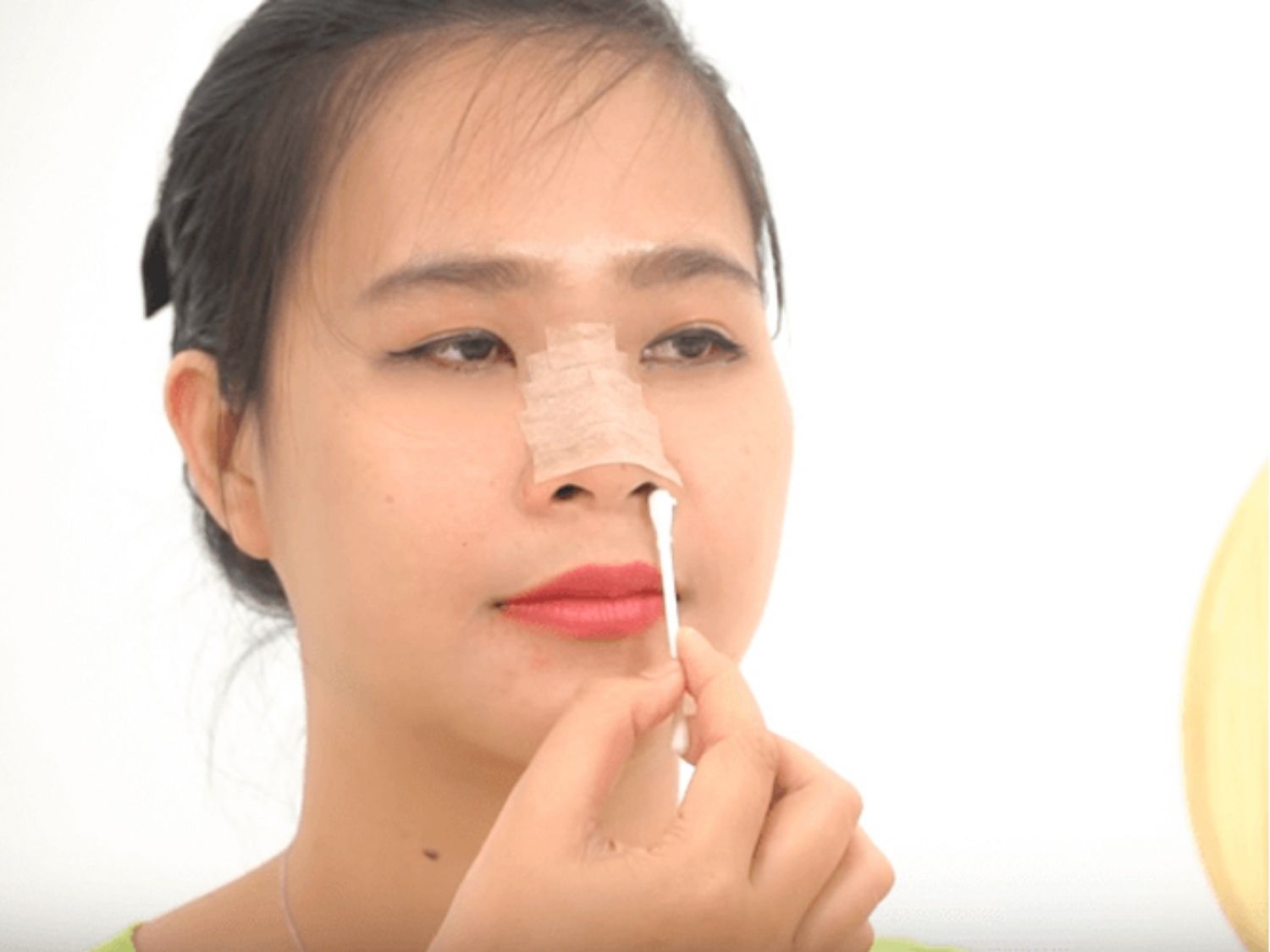 sau nâng mũi khách hàng cần vệ sinh vùng mũi nhẹ nhàng để tránh lệch sống