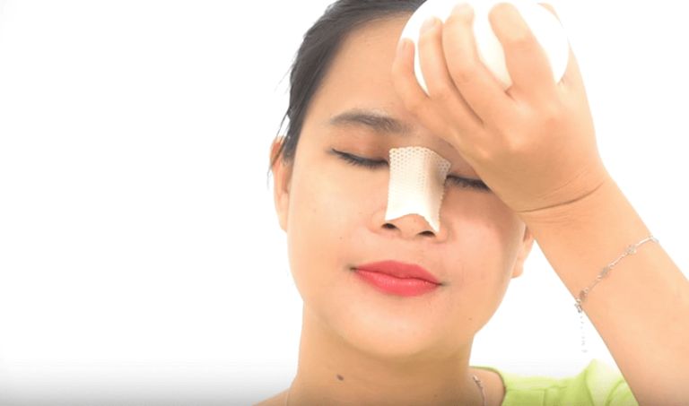 Sưng đau sau khi nâng mũi là bình thường do cơ thể phản ứng trước tác động ngoại khoa