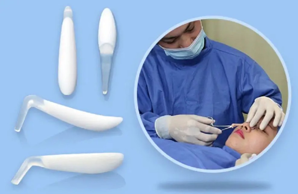 Bác sĩ tư vấn vật liệu nâng mũi sụn tự thân bọc đầu mũi và sụn nhân tạo định hình sống mũi.