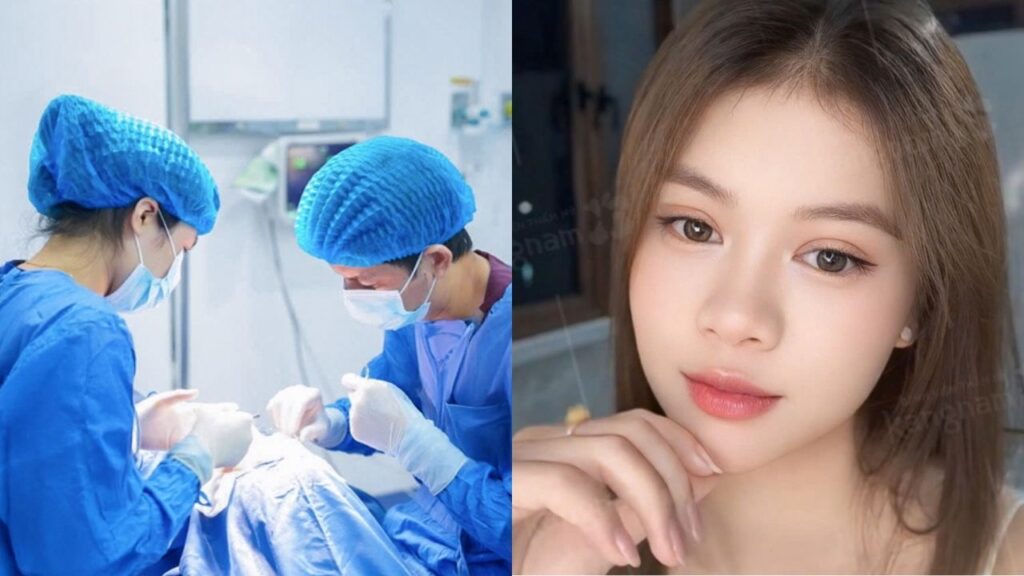 Nâng mũi có bền không? Tuổi thọ thực tế và bí quyết giữ dáng mũi trọn đời