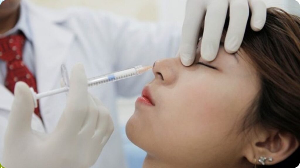Nâng mũi không phẫu thuật: Đẹp tức thì hay tiềm ẩn hiểm họa? Review từ chuyên gia
