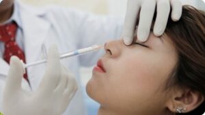 Review nâng mũi không phẫu thuật 2026: Đẹp cấp tốc hay biến chứng tiềm ẩn