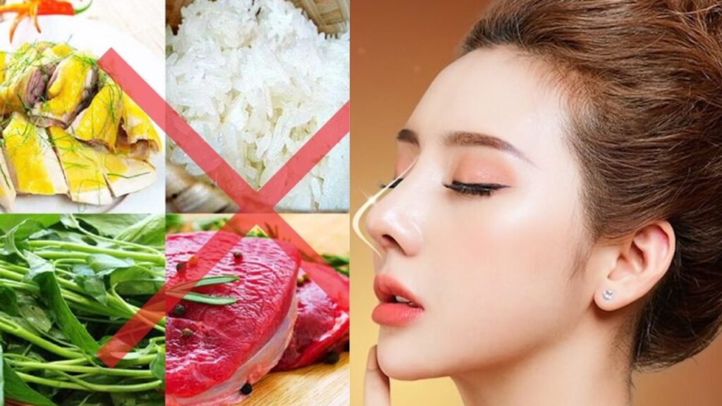 Nâng mũi kiêng gì? Review thực đơn & Thói quen “sống còn” để mũi đẹp trọn đời