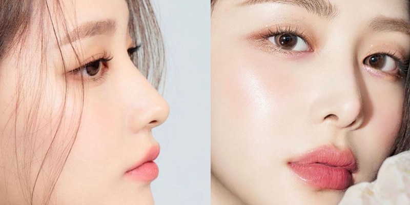 Cần kiêng cữ cẩn thận sau nâng mũi để hạn chế biến chứng