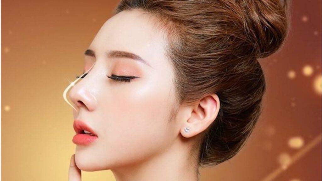 Nâng mũi mất bao lâu? Mốc thời gian thực tế để mũi đẹp hoàn toàn