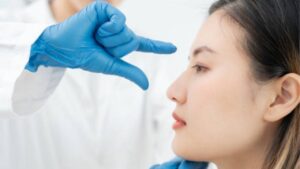 Thời gian nâng mũi và quá trình phục hồi 2026: Nâng mũi bao lâu thì được rửa mặt, cắt chỉ và ổn định