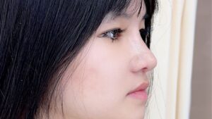 Review dáng mũi S-line và L-line 2026: Đặc điểm, đối tượng và lộ trình ổn định form dáng