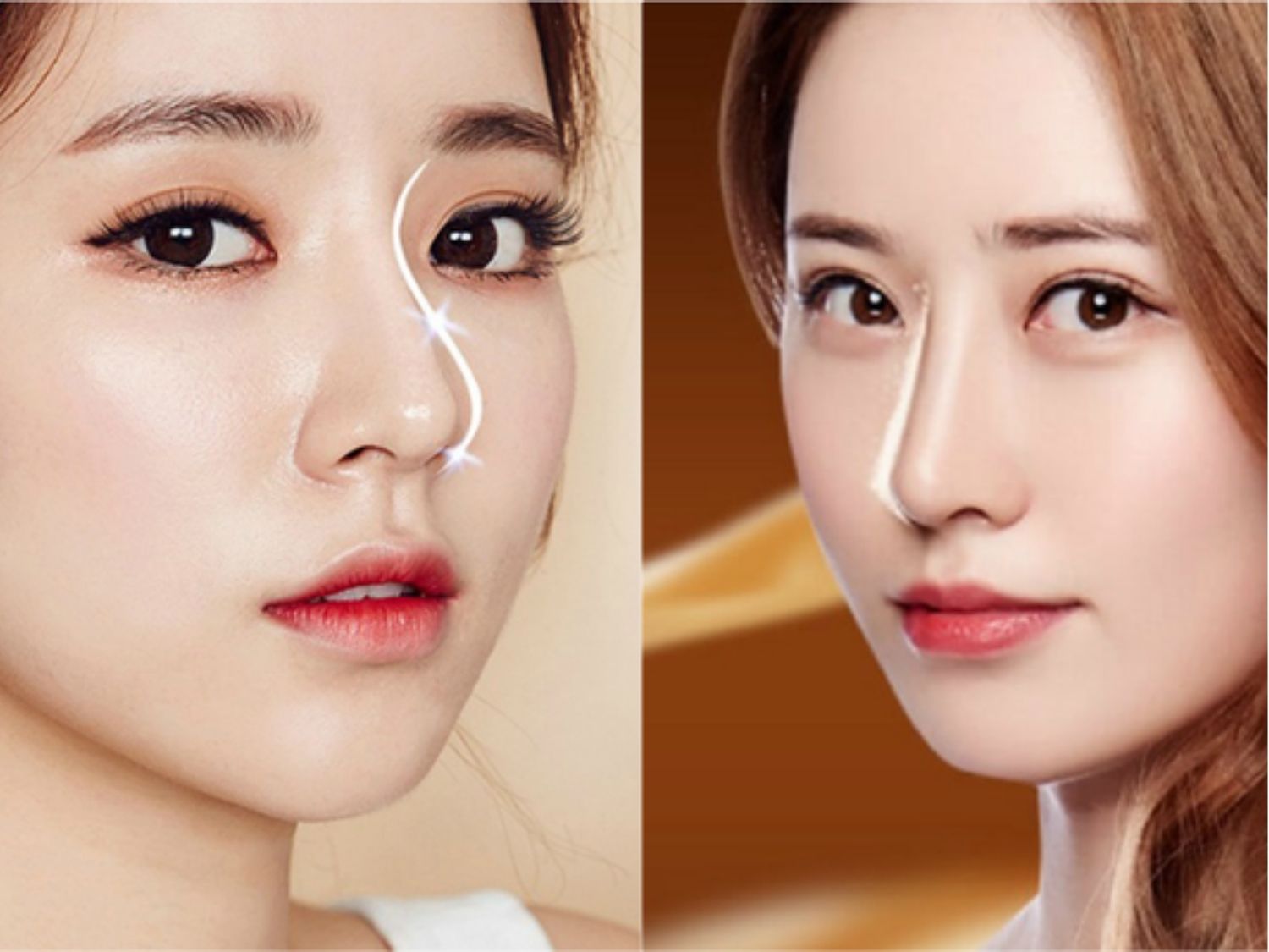 ảnh so sánh dáng mũi S-line và L-line để khách hàng hiểu rõ hơn đây là 2 dáng mũi chứ không phải là kỹ thuật hay công nghệ