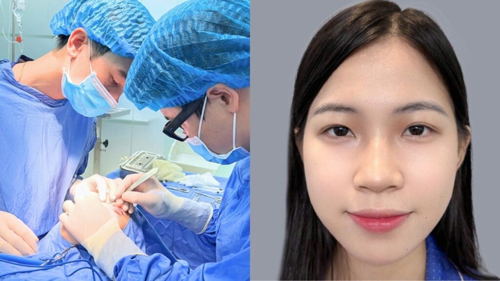 Cắt mí phương pháp nào tốt nhất? Cách chọn kỹ thuật chuẩn y khoa cho từng dáng mắt