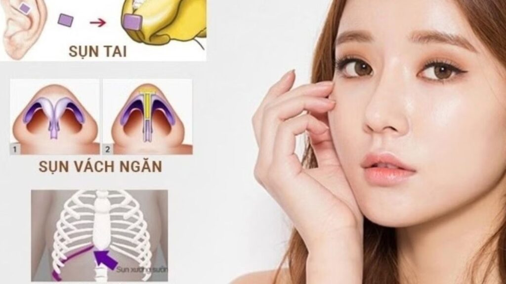 Nên dùng sụn nào để nâng mũi? Bác sĩ giải đáp theo từng dáng mũi