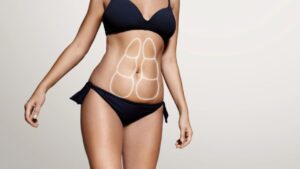 Người gầy có nên hút mỡ không? Kỹ thuật tạo hình và lưu ý an toàn từ chuyên gia