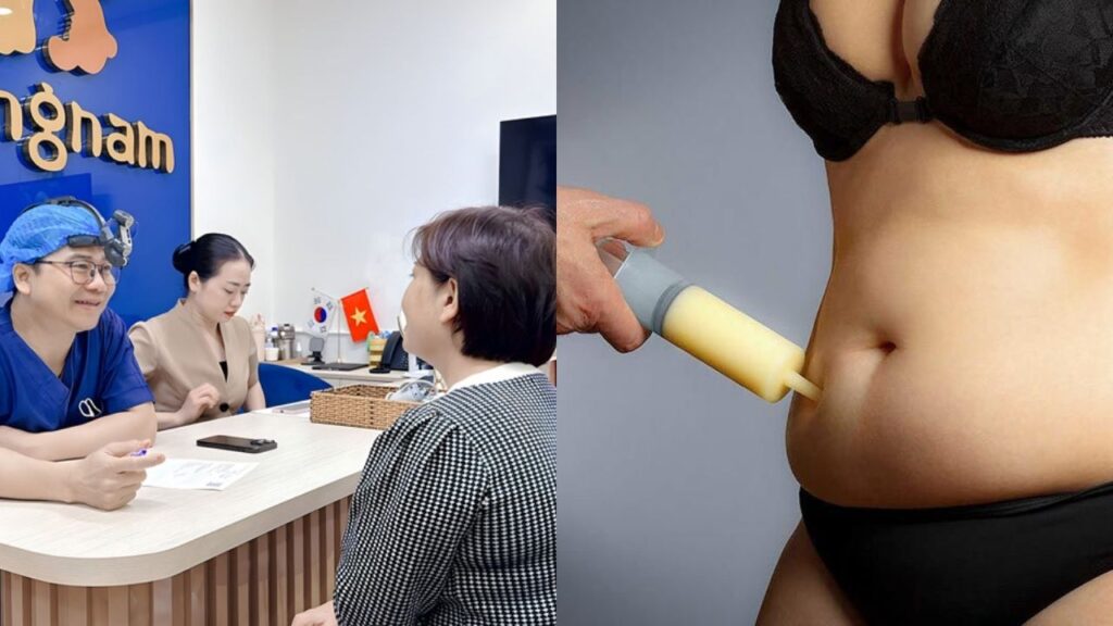 Người lớn tuổi có hút mỡ được không? 55 – 60 tuổi có nguy hiểm không?