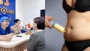 Người lớn tuổi có hút mỡ được không? 55 – 60 tuổi có nguy hiểm không?