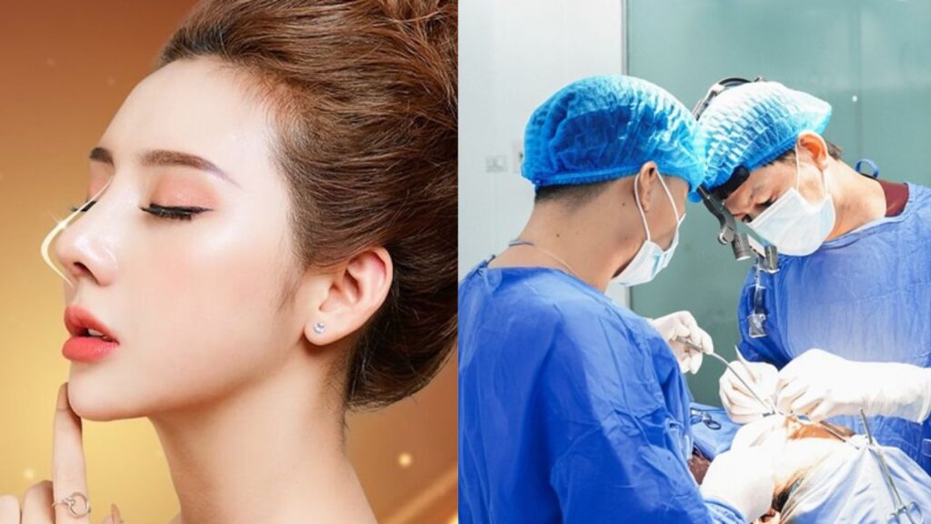 Quy trình nâng mũi chuẩn Y khoa 8 bước: An toàn tuyệt đối & Không biến chứng