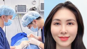 Quy trình vô trùng cắt mí: 6 bước ngăn ngừa nhiễm trùng chuẩn Y khoa