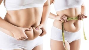 Sau hút mỡ có cần hút dịch không? Phân biệt tụ dịch và sưng bình thường sau hút mỡ