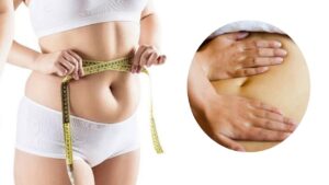 Hướng dẫn massage dẫn lưu sau hút mỡ: Cách thực hiện an toàn, Tần suất và Lưu ý để tránh tụ dịch