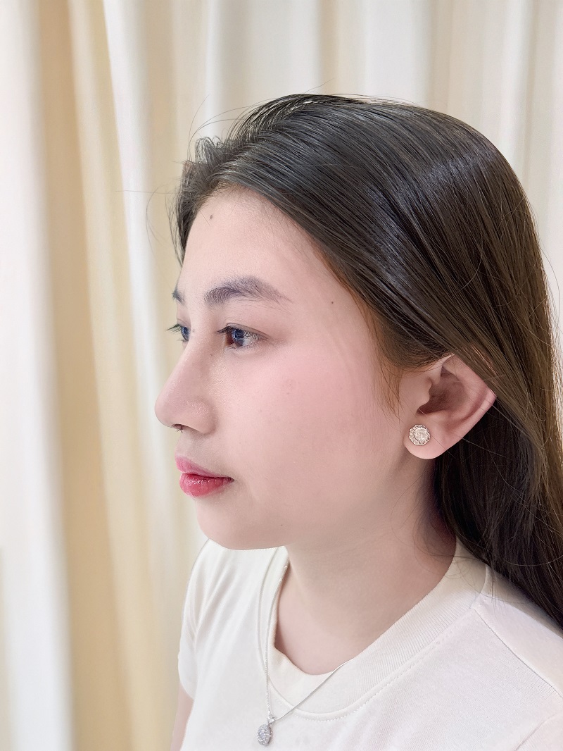 Góc nghiêng dáng mũi thẳng, thon gọn, tự nhiên