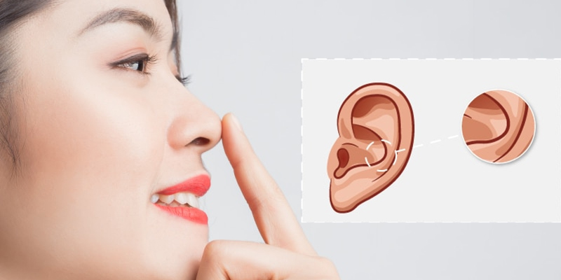 Sụn tai nâng mũi giúp độ mềm tương đồng với sụn đầu mũi thật.