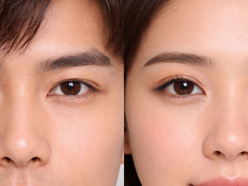 Cắt mí nam giới ưu tiên nếp mí thấp tự nhiên giữ vững nét nam tính và chiều sâu cho đôi mắt.