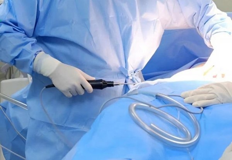 Bác sĩ thực hiện hút mỡ quá sâu không đều tay dẫn đến lồi lõm bề mặt vùng hút mỡ