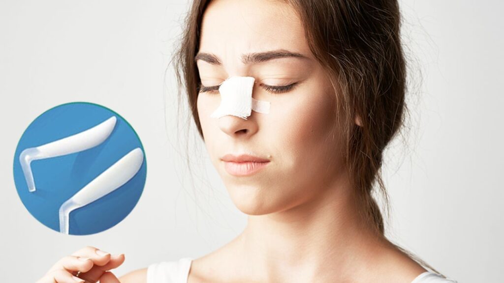 Sụn nâng mũi có bị đào thải không? 5 dấu hiệu nhận biết và phác đồ xử lý an toàn