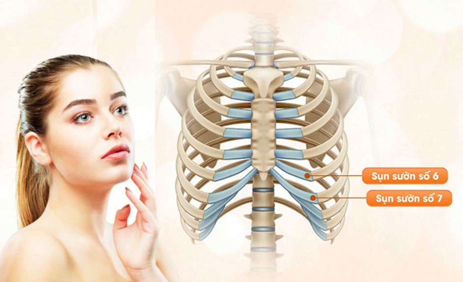 Sụn sườn là loại sụn bền nhất, ít biến chứng được sử dụng trong các ca phẫu thuật nâng mũi khó