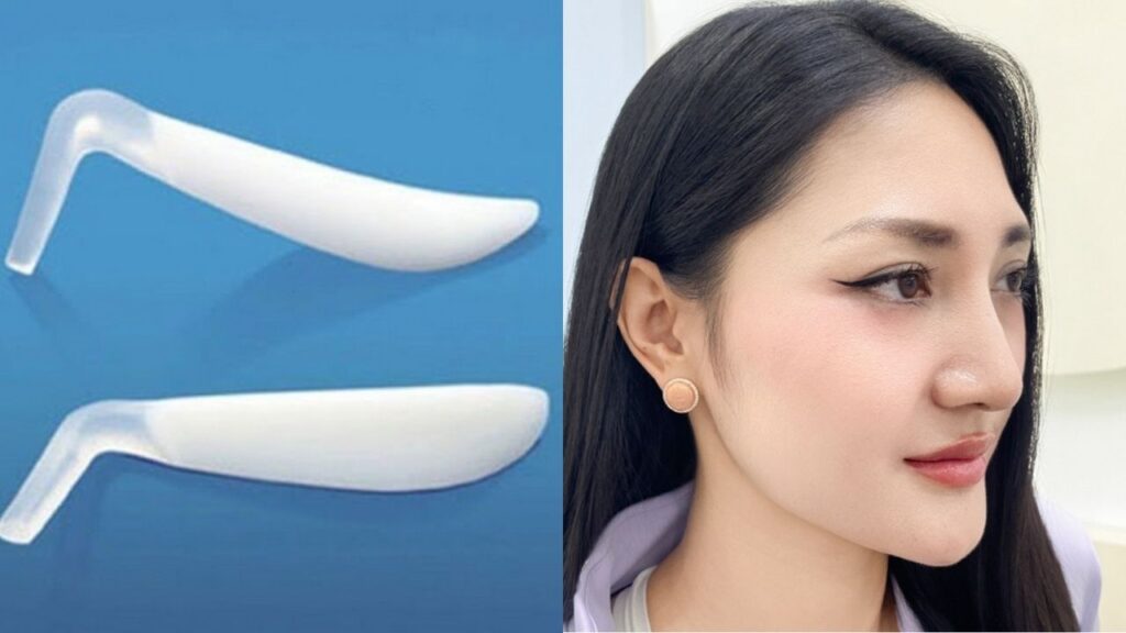 Sụn nhân tạo nâng mũi: Review 5 loại sụn tốt nhất và Bí quyết chọn độ cao bền vững