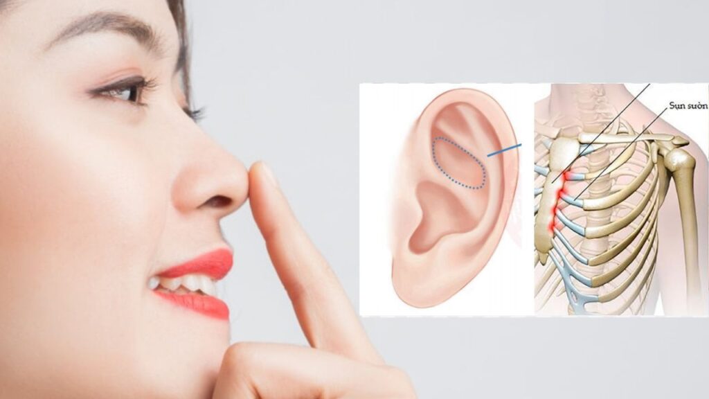 Nâng mũi sụn tai hay sụn sườn tốt hơn? Review chi tiết