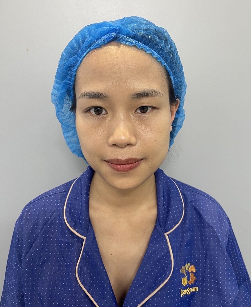 Thanh Trang có đôi mắt nhỏ, nếp mí không đều