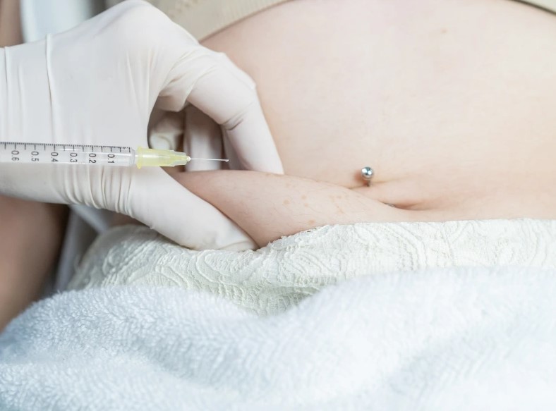 Kết quả thực tế sau 8 tuần thực hiện công nghệ giảm mỡ bụng không xâm lấn.