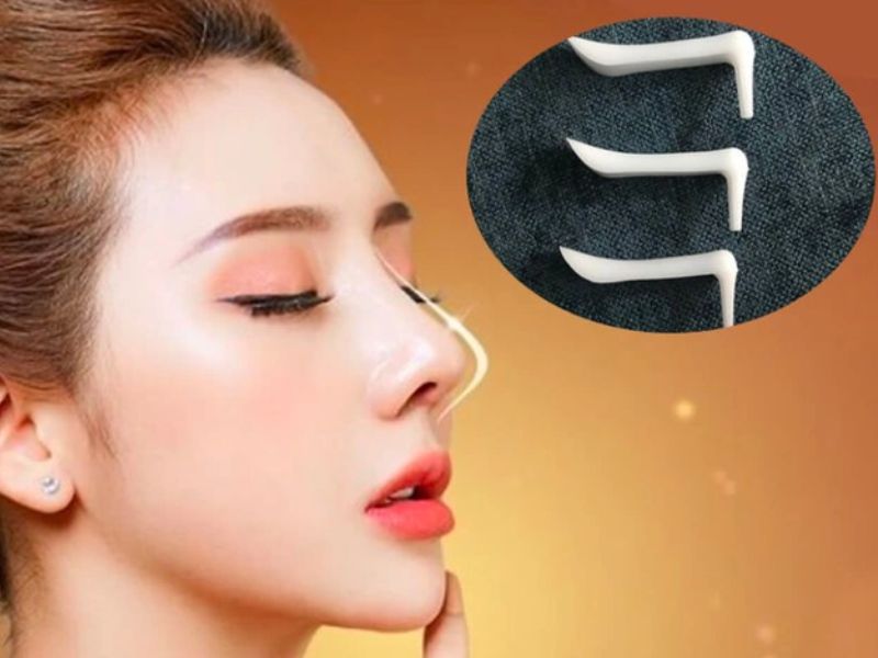 Loại sụn nâng mũi ảnh hưởng trực tiếp tới dáng mũi và tự nhiên trong quá trình phẫu thuật