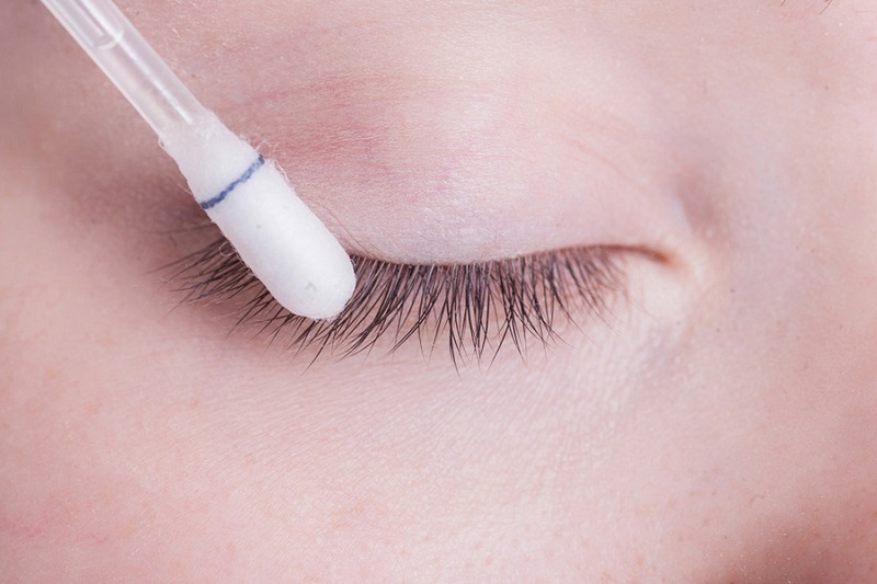 Hướng dẫn vệ sinh vết thương tại nhà giúp mí nhanh hết sưng