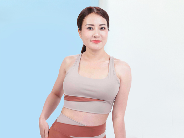 Hình ảnh minh họa vùng bụng sau 1 tháng: Form dáng đã lộ diện nhưng mô mềm vẫn đang trong quá trình ổn định.