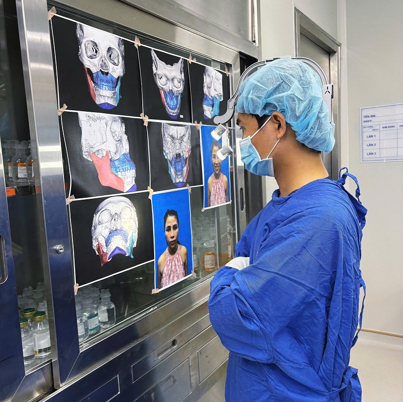 Phim chụp CT Cone Beam 3D xác định sơ đồ dây thần kinh hàm dưới để ngăn ngừa biến chứng tê môi cằm tại Kangnam.