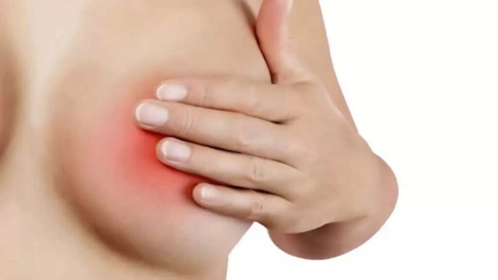 Biến chứng sau nâng ngực: Dấu hiệu nhận biết & Phác đồ xử lý 2026