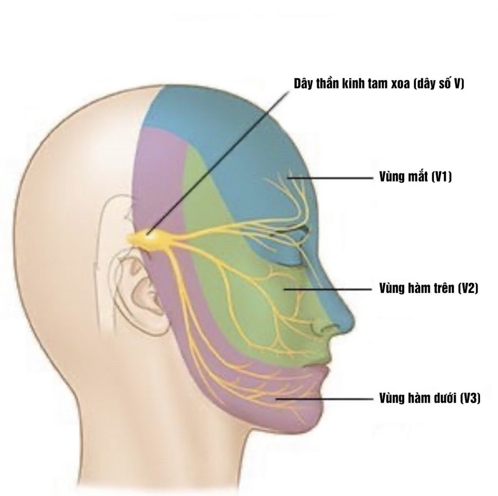 Bản đồ phân bố nhánh thần kinh V3 xương ổ răng dưới và nhánh bờ hàm dây VII biểu thị vùng nguy cơ tê bì khi thực hiện gọt hàm V-line.]