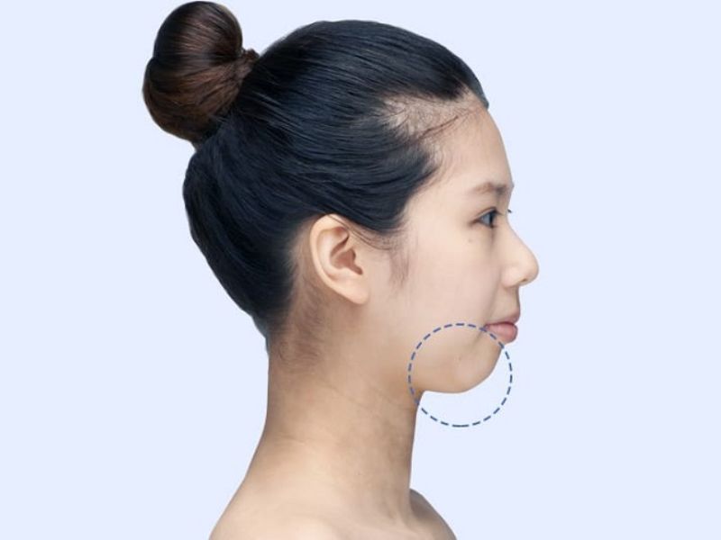 Tỉ lệ vàng khuôn mặt trán mũi cằm đối cho người cằm ngắn.