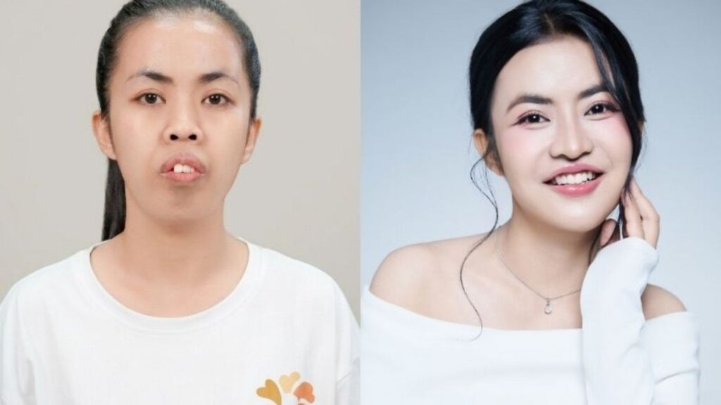 [Review] Top 8 câu chuyện cảm động nhất Hành Trình Lột Xác: My nạo dừa, Lan SOS giờ ra sao?