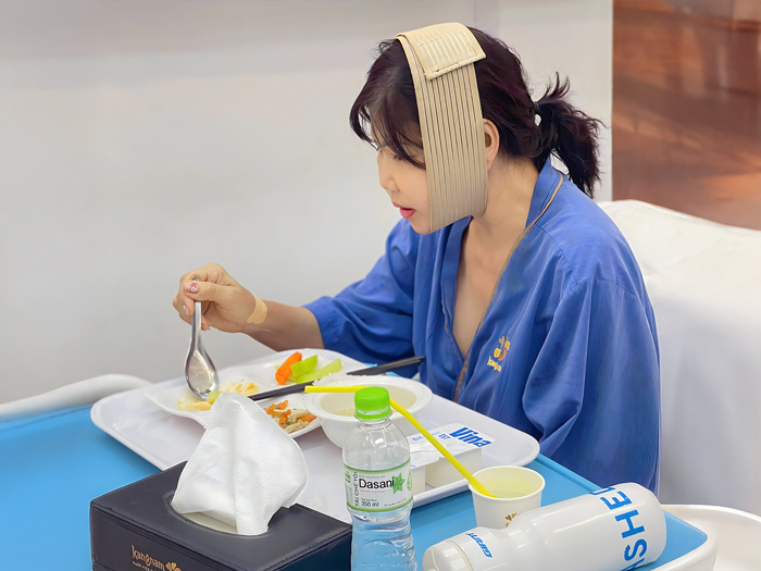 Ăn đồ mềm và đeo đai định hình cho gương mặt