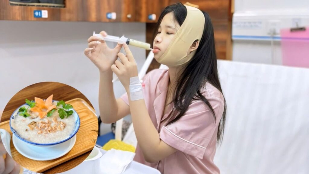 Chỉnh hàm bao lâu ăn nhai bình thường? Lịch trình phục hồi nhanh từ chuyên gia