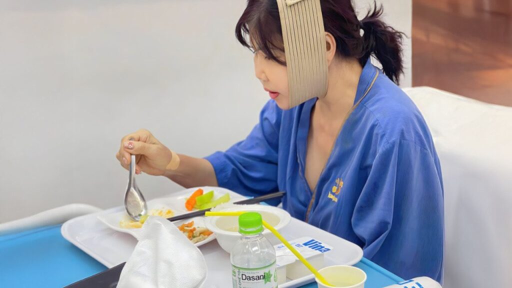 Chỉnh hàm có ảnh hưởng ăn nhai không? Lộ trình 5 giai đoạn phục hồi cơ năng chuẩn y khoa