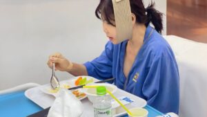 Chỉnh hàm có ảnh hưởng ăn nhai không? Lộ trình 5 giai đoạn phục hồi cơ năng chuẩn y khoa