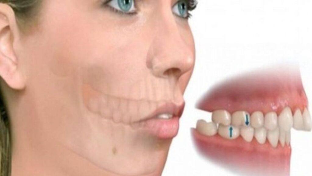 Chỉnh hàm có thay đổi tướng số không? Góc nhìn nhân tướng học và khoa học