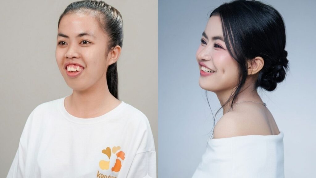 Cô gái nạo dừa và giấc mơ đổi đời: Trà My tại Hành trình Lột xác mùa 7