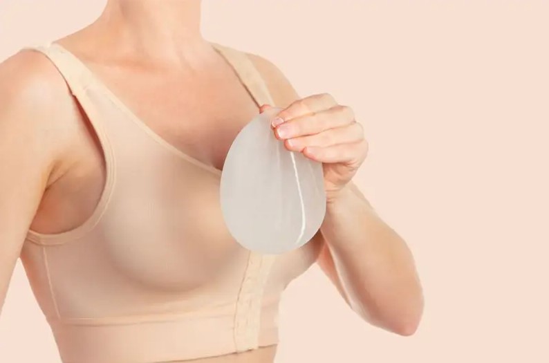 Cần sửa lại túi nâng ngực để tránh gây biến chứng