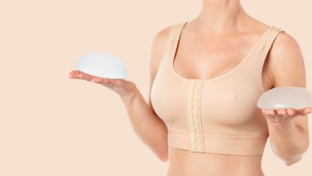 Review túi ngực 250cc: Hình ảnh thực tế, độ nhô và 7 lưu ý từ chuyên gia