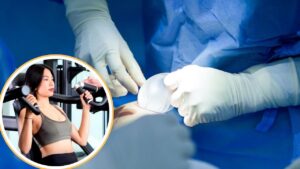 Đặt túi dưới cơ có ảnh hưởng vận động không? Lộ trình tập Gym và chơi thể thao an toàn sau nâng ngực