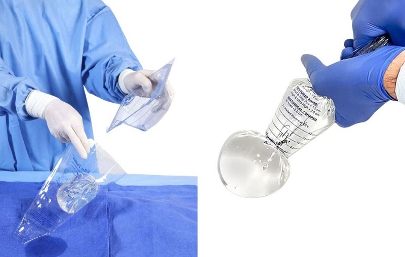 Dùng phễu Keller để đưa túi ngực vào khoang ngực